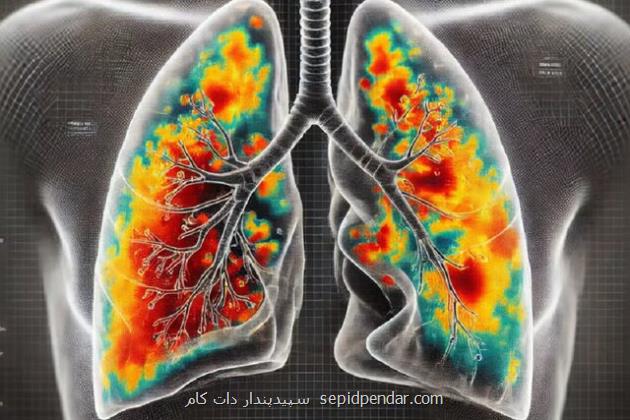تشخیص بیماری های ریوی با هوش مصنوعی
